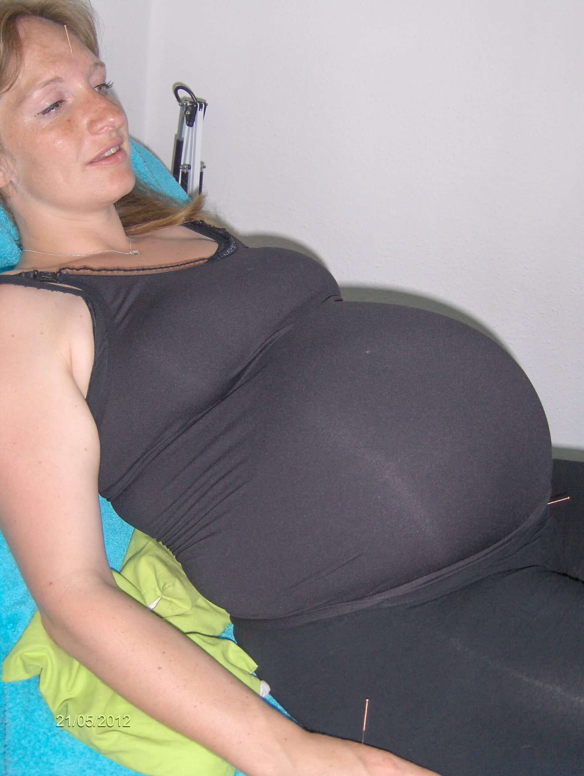 akupunktur til gravide - graviditetsgener, modning, igangsættelse